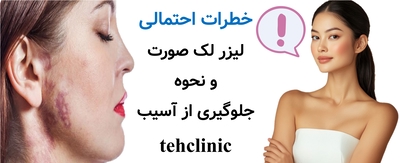 خطرات احتمالی لیزر لک صورت و نحوه جلوگیری از آسیب