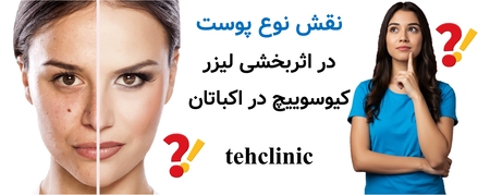 نقش نوع پوست در اثربخشی لیزر کیوسوییچ در اکباتان