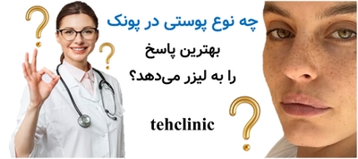 چه نوع پوستی در پونک بهترین پاسخ را به لیزر می‌دهد؟