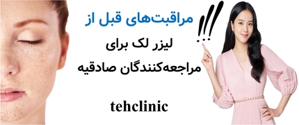 مراقبتهای قبل از لیزر لک برای مراجعهکنندگان صادقیه