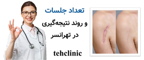 تعداد جلسات و روند نتیجهگیری در تهرانسر