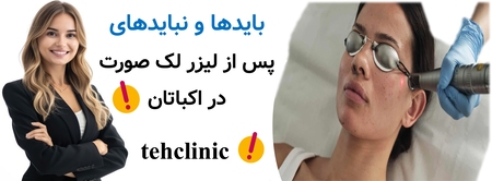 بایدها و نبایدهای پس از لیزر لک صورت در اکباتان