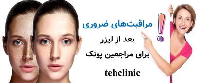 مراقبت‌های ضروری بعد از لیزر برای مراجعین پونک