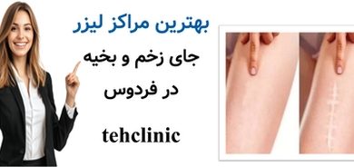 بهترین مراکز لیزر جای زخم و بخیه در فردوس