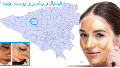 فیشیال و پاکسازی پوست جنت اباد