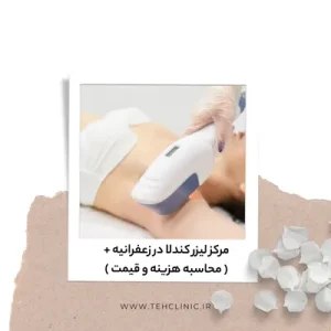 مرکز لیزر کندلا در زعفرانیه + ( محاسبه هزینه و قیمت )