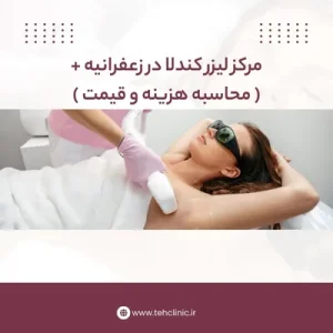 مرکز لیزر کندلا در زعفرانیه + ( محاسبه هزینه و قیمت )