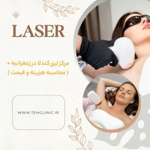 مرکز لیزر کندلا در زعفرانیه + ( محاسبه هزینه و قیمت )
