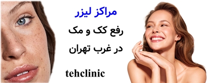 مراکز لیزر رفع کک و مک در غرب تهران