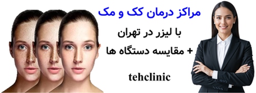 مراکز درمان کک و مک با لیزر در تهران + مقایسه دستگاه ها