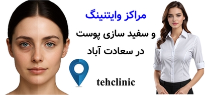 مراکز وایتنینگ و سفید سازی پوست در سعادت آباد