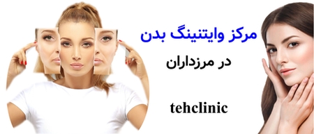 مرکز وایتنینگ بدن در مرزداران