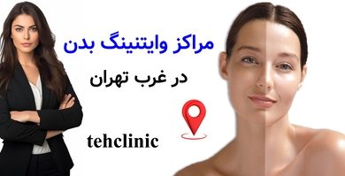 مراکز وایتنینگ بدن در غرب تهران