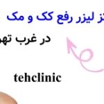مراکز لیزر رفع کک و مک در غرب تهران