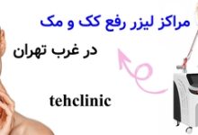 مراکز لیزر رفع کک و مک در غرب تهران