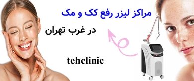مراکز لیزر رفع کک و مک در غرب تهران