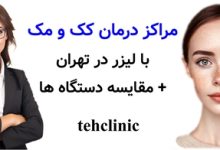 مراکز درمان کک و مک با لیزر در تهران + مقایسه دستگاه ها