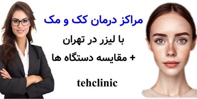 مراکز درمان کک و مک با لیزر در تهران + مقایسه دستگاه ها