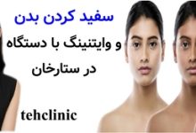 سفید کردن بدن و وایتنینگ با دستگاه در ستارخان
