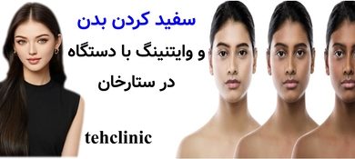سفید کردن بدن و وایتنینگ با دستگاه در ستارخان