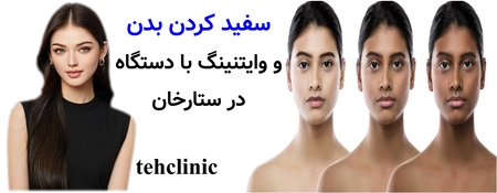 سفید کردن بدن و وایتنینگ با دستگاه در ستارخان