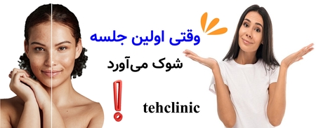 وقتی اولین جلسه شوک می‌آورد