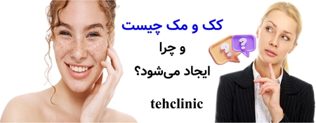 کک و مک چیست و چرا ایجاد می‌شود؟