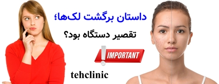 داستان برگشت لک‌ها؛ تقصیر دستگاه بود؟