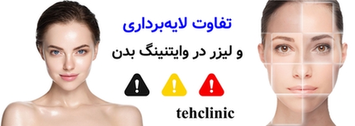 تفاوت لایهبرداری و لیزر در وایتنینگ بدن
