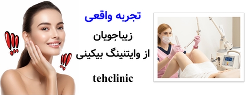 تجربه واقعی زیباجویان از وایتنینگ بیکینی