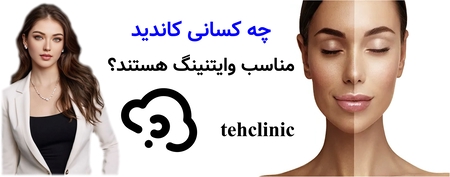 چه کسانی کاندید مناسب وایتنینگ هستند؟