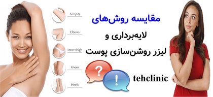 مقایسه روشهای لایهبرداری و لیزر روشنسازی پوست
