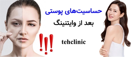 حساسیتهای پوستی بعد از وایتنینگ