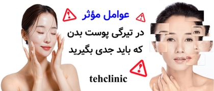 عوامل مؤثر در تیرگی پوست بدن که باید جدی بگیرید