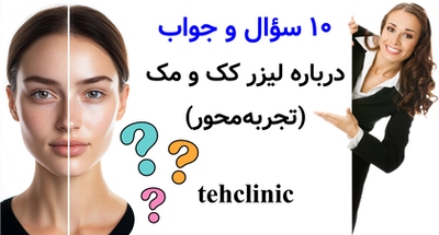 سؤال و جواب درباره لیزر کک و مک (تجربه‌محور)