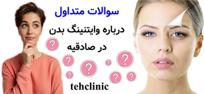 سوالات متداول درباره وایتنینگ بدن در صادقیه