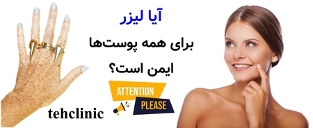 آیا لیزر برای همه پوست‌ها ایمن است؟