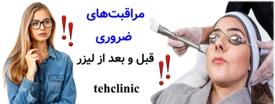مراقبت‌های ضروری قبل و بعد از لیزر