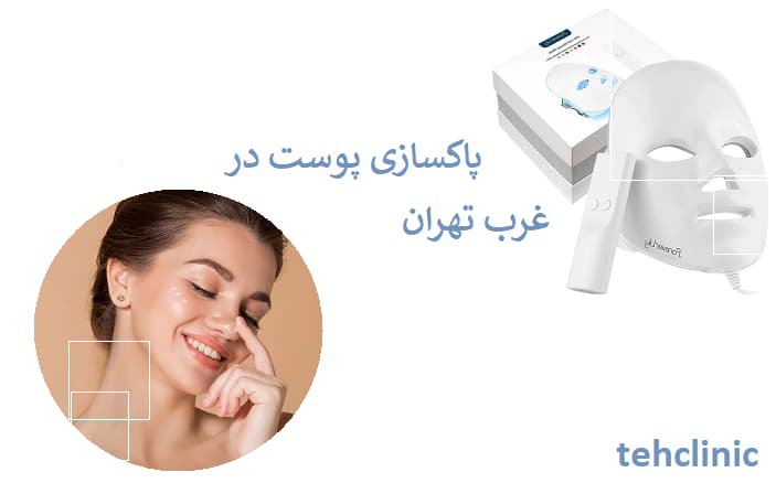 پاکسازی پوست در غرب تهران