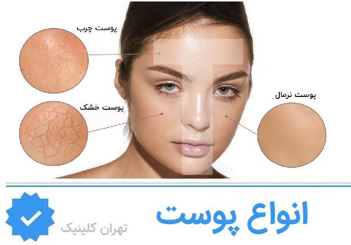 انواع پوست