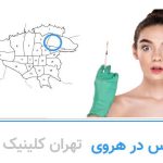 بوتاکس هروی