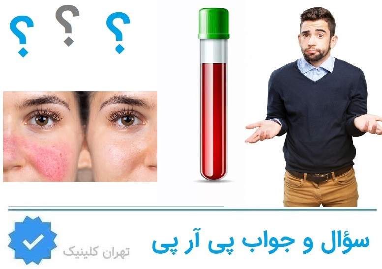 سوال پی ار پی