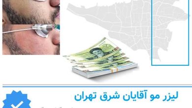 لیزر اقایان شرق تهران