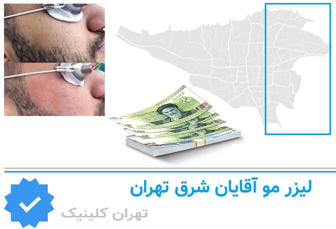 لیزر اقایان شرق تهران