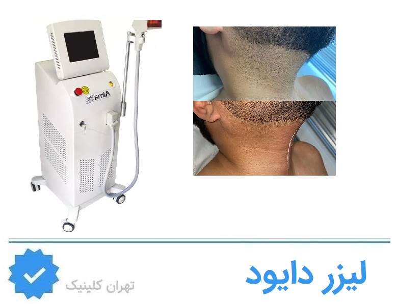 لیزر دایود (Diode 805–810nm)؛ تعادل بین ایمنی و اثربخشی