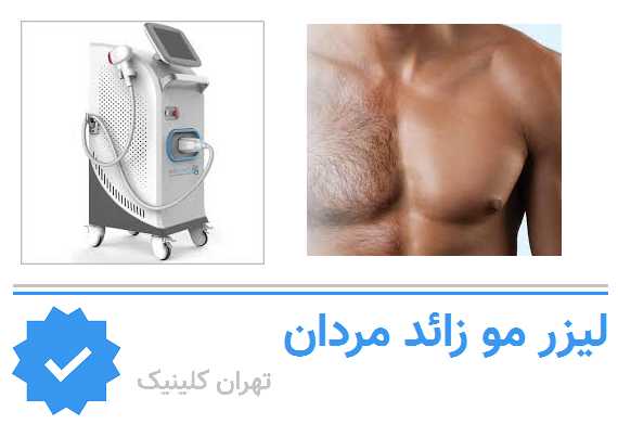 لیزر موهای زائد آقایان در شرق تهران