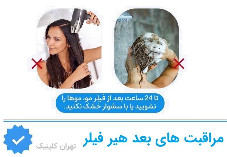 مراقبت‌های بعد از تزریق هیر فیلر