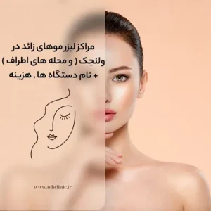 مراکز لیزر موهای زائد در ولنجک ( و محله های اطراف ) + نام دستگاه ها , هزینه