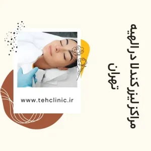 مراکز لیزر کندلا در الهیه تهران