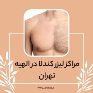 مراکز لیزر کندلا در الهیه تهران